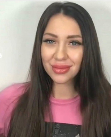 Алена Рапунцель увеличила губы!