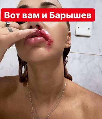 Стецевят и Барышев Любовь закончилась дракой