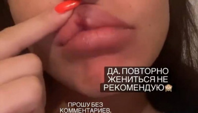 Беременную Жарикову опять избил муж?