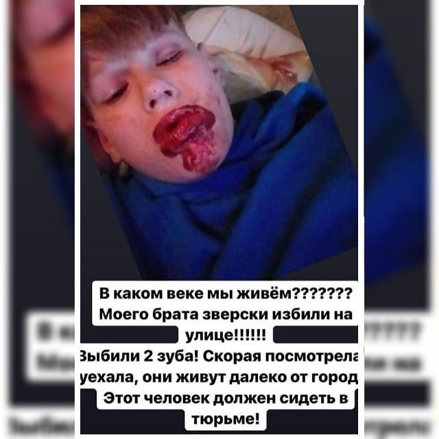 Брата Саши Черно зверски избили.